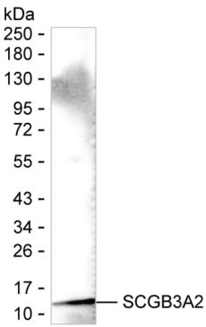 SCGB3A2